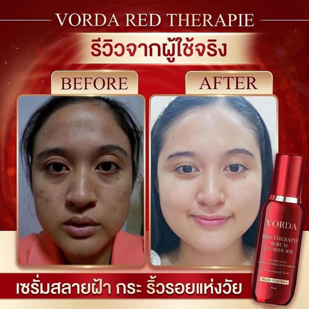 Vorda Red Therapie Serum