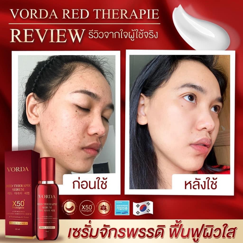 Vorda Red Therapie Serum