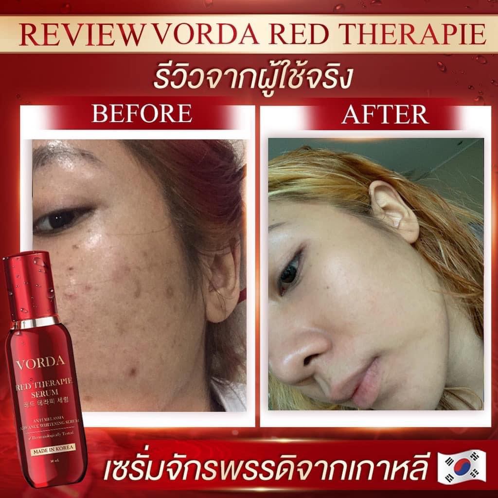 Vorda Red Therapie Serum