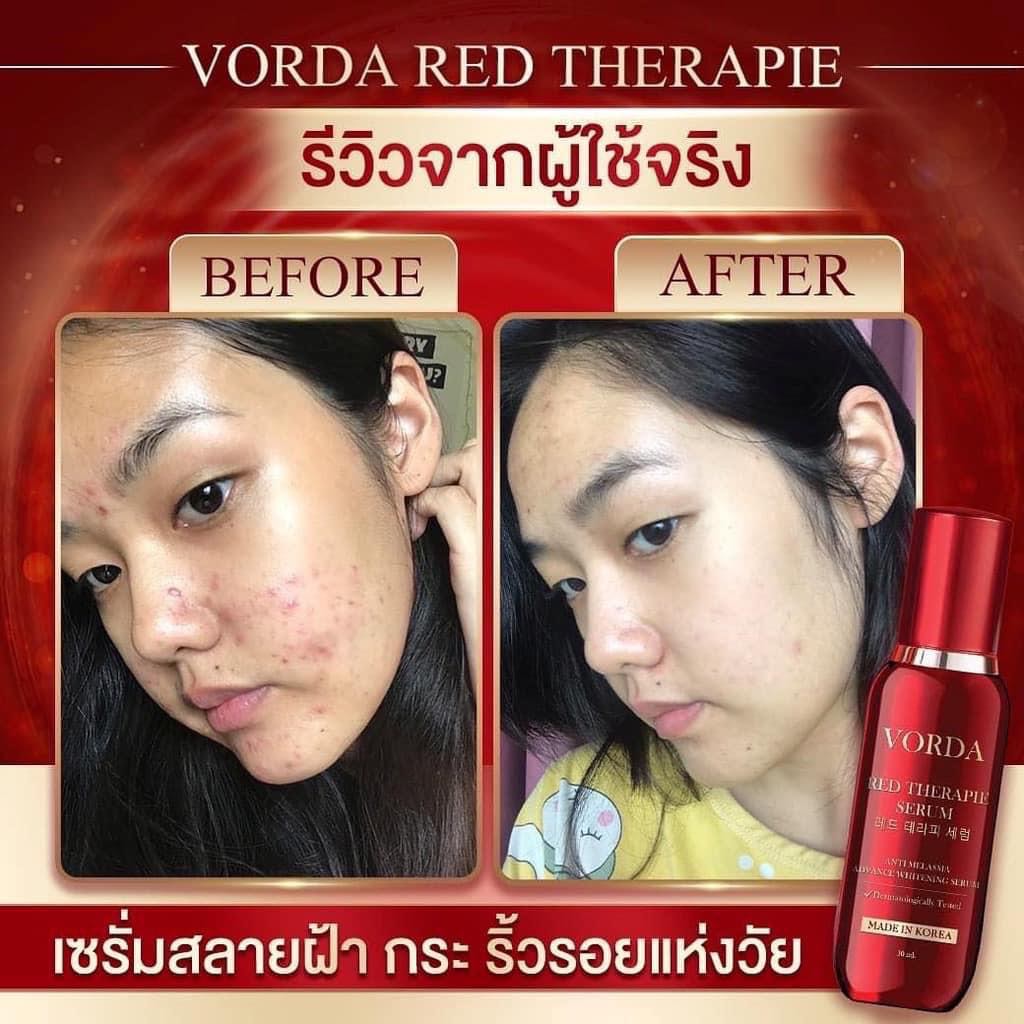 Vorda Red Therapie Serum