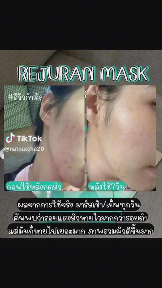 Rejuran Healer Healing Mask